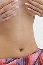 Tummy tuck 